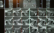 3D-Diagnostik_4